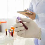 Cum se fac analizele? Cum de nu se încurcă probele între ele? De unde știm dacă e virus sau bacterie? (p)