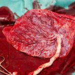 Teodora a murit pentru că medicii nu și-au făcut treaba. Pentru că abuzurile sunt tolerate. Pentru că România